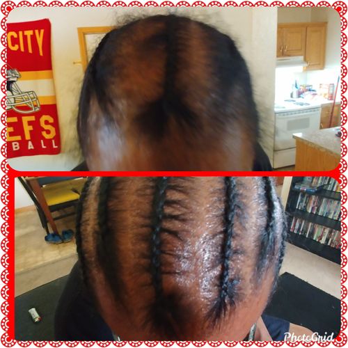 Customer photo review of PureFix Hair Elixir