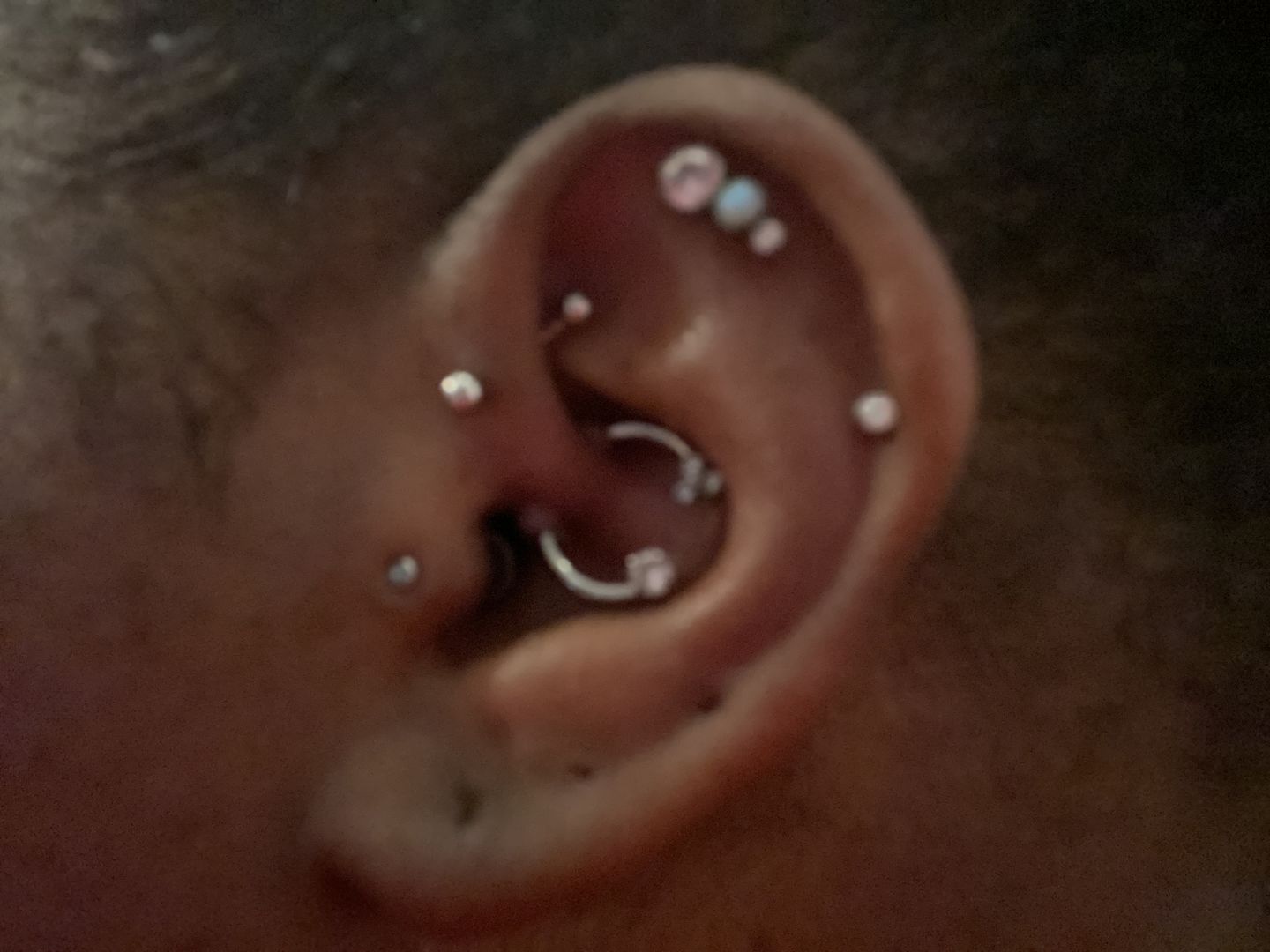 Customer photo review of NeilMed Sterile Saline Piercing Aftercare