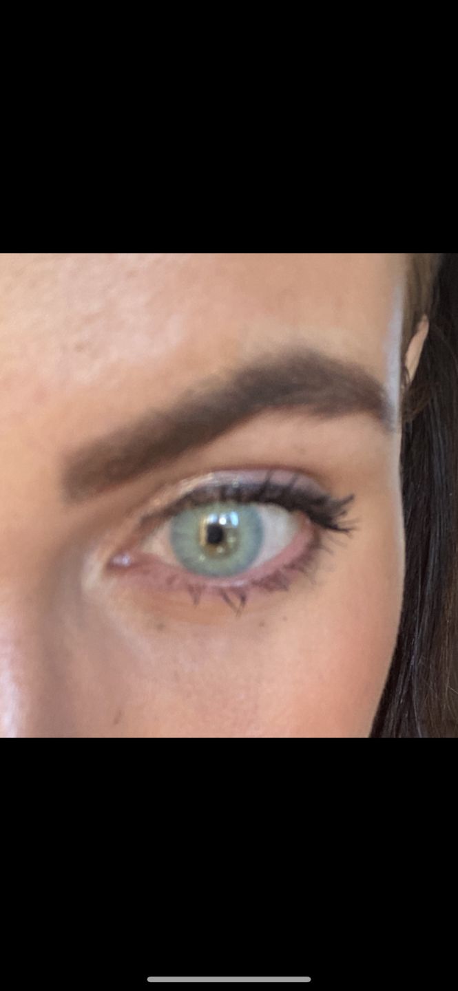 Customer photo review of Siesta Original Aqua