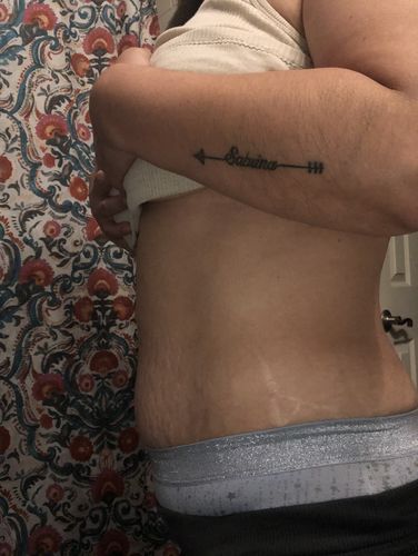 Customer photo review of 45 Uses Herbal Magnesium Therapy Wrap: Legs/Core