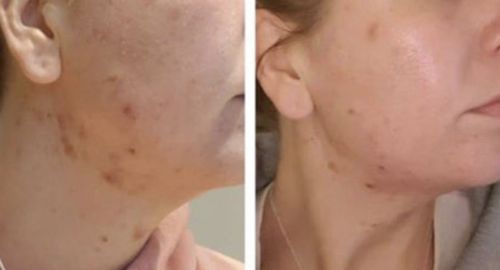 Customer photo review of Lumière Rouge ™