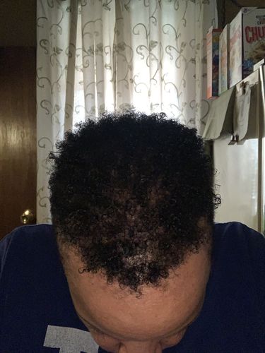 Customer photo review of Nae Nae's Hair Boost 9oz