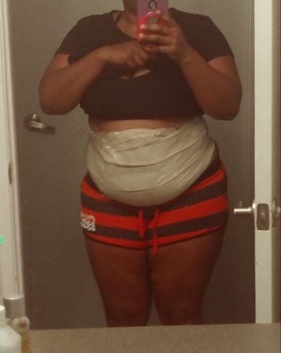 Customer photo review of 15 Uses Magnesium Therapy Herbal Wrap