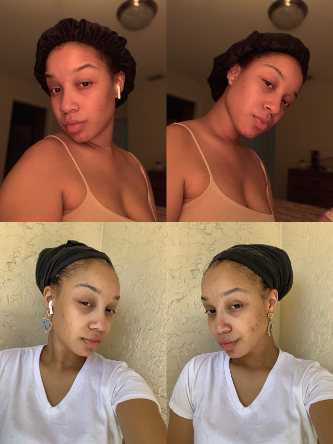 Customer photo review of Bolden Clear Skin Kit