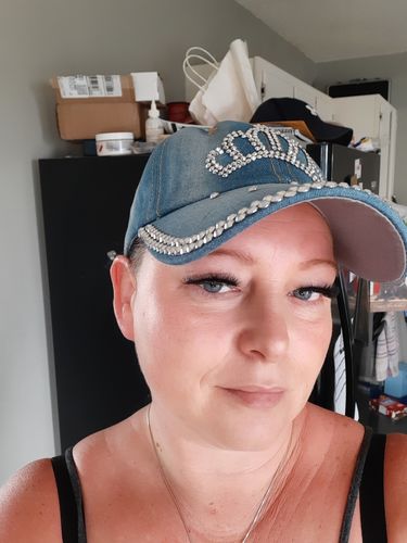 Customer photo review of Scalpa Saline PMU Removal Kit & Training