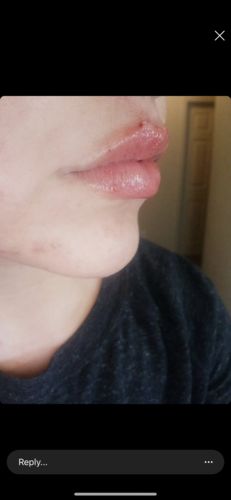 Customer photo review of Scalpa HyaInfuse