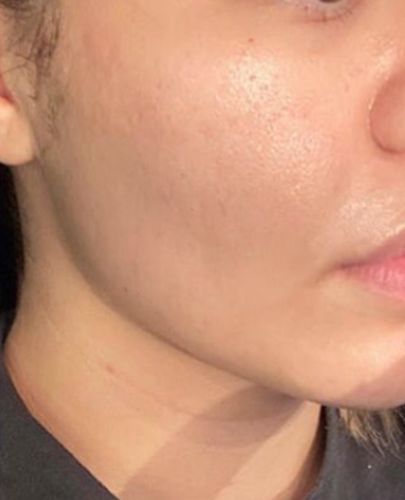 Customer photo review of Lumière Rouge ™