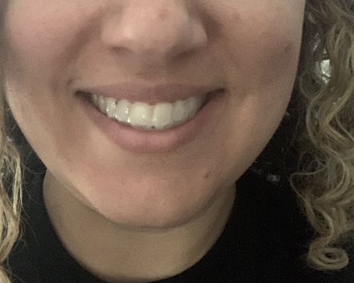 Customer photo review of Night Guard