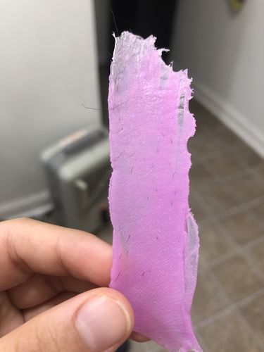 Customer photo review of At-Home Signature Series Hair Removal Wax