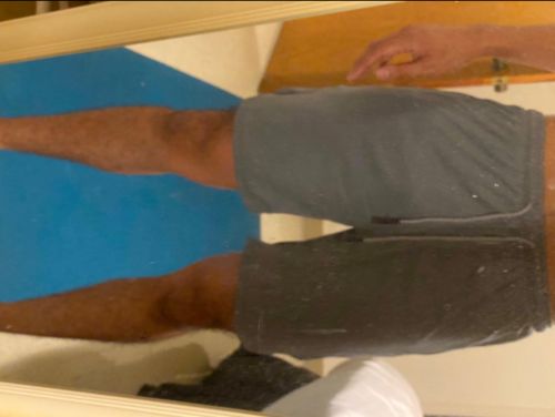 Customer photo review of 7" Pocket Hybrid Shorts