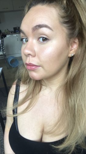 Customer photo review of Rosalique 3 in 1 Anti-Redness Miracle Formula SPF50