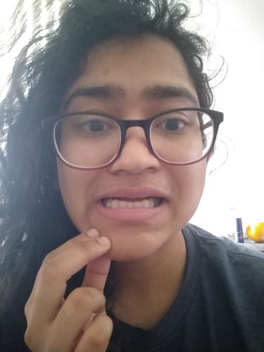 Customer photo review of Night Guard