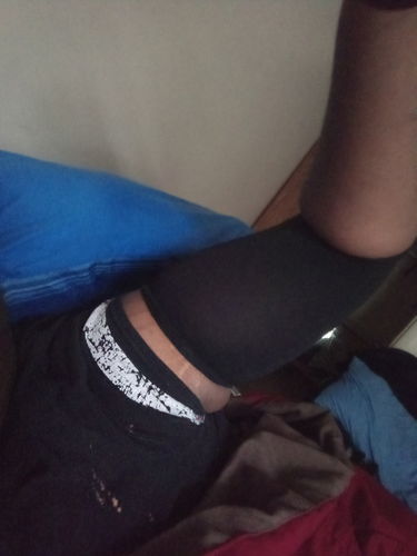 Customer photo review of Arm and Leg Sleeves Slimming Shaper - Pair