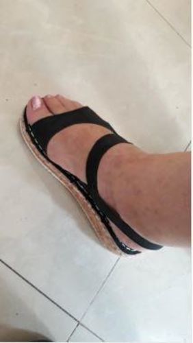 Customer photo review of BESTWALK™ - PREMIUM ORTHOPEDIC HOOK & LOOP SANDAL