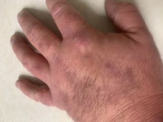 Customer photo review of Combat Ready Ointment - Everyday Carry