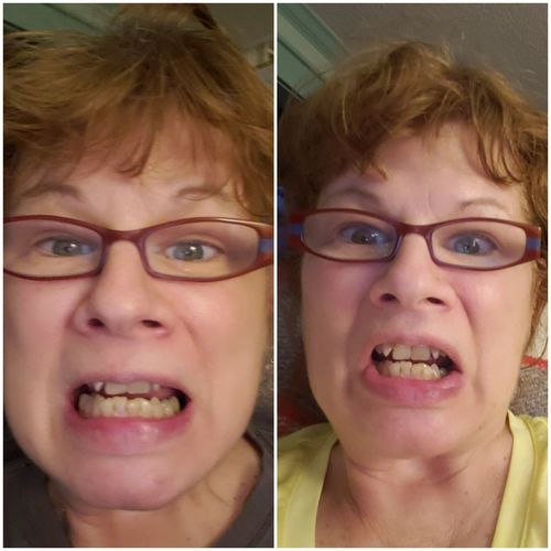 Customer photo review of Nano Silver 3 Tube Multi-Pack