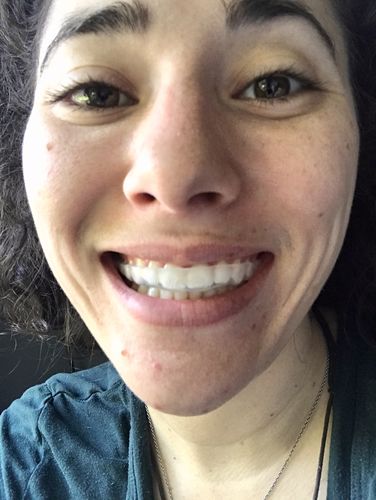 Customer photo review of Night Guard