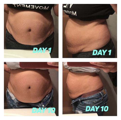 Customer photo review of 15 Uses Magnesium Therapy Herbal Wrap