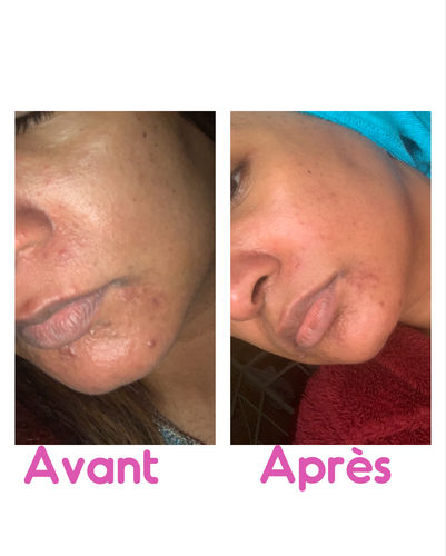 Customer photo review of Good Detox Essentiel - 1 mois