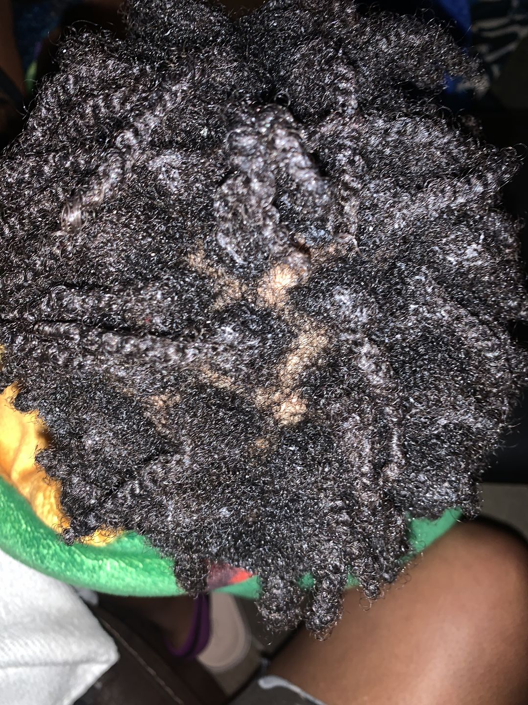 Customer photo review of Intense Deep Conditioning Treatment (2.5 oz)