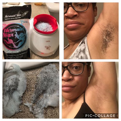 Customer photo review of At-Home Signature Series Hair Removal Wax