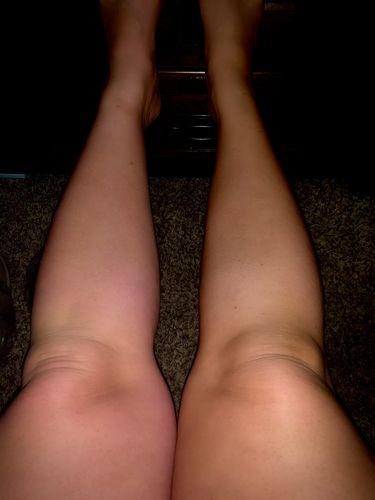 Customer photo review of Desert Bronze Tanning Mousse NO MITT