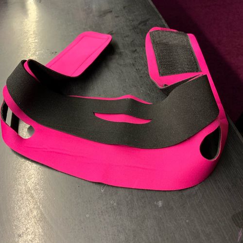 Customer photo review of LessFaceFat™ | De oplossing tegen gezichtsvet