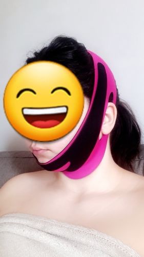 Customer photo review of LessFaceFat™ | De oplossing tegen gezichtsvet