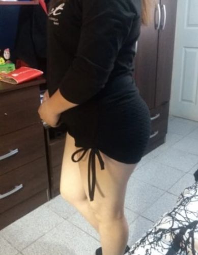 Customer photo review of GYMKARTEL® ANTI-CELLULITE AND PUSH UP SHORTS - BLACK