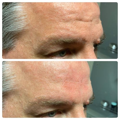 Customer photo review of Scalpa HyaInfuse