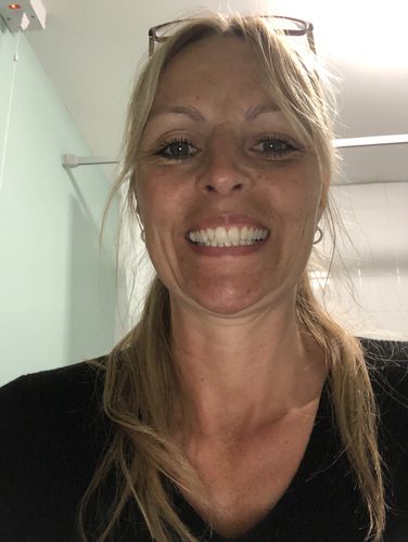 Customer photo review of Teeth Whitening Kit