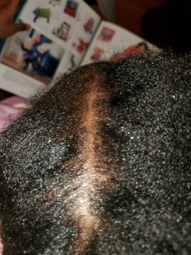 Customer photo review of All Natural Hair Growth kit