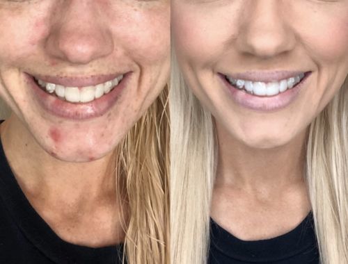 Customer photo review of ERGONOMIC DENSITY BRUSH - UP TO 60% OFF LAST DAY PROMOTION! + FREE GIFT