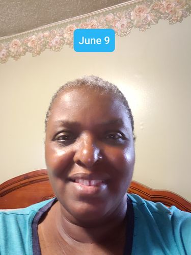 Customer photo review of Nae Nae's 9oz Hair Boost Special