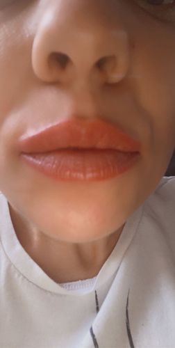 Customer photo review of LIP BOOSTING SYSTEM