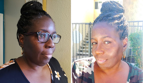 Customer photo review of BERRI-CLEAR+™ SUPERFRUIT 5 BERRY SERUM