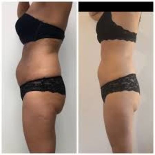 Customer photo review of FitKry™ - T-shirt minceur