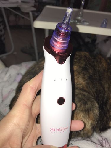 Customer photo review of SkinGlow Electric Cleanser - No More Blackheads