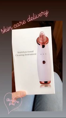 Customer photo review of SkinGlow Electric Cleanser - No More Blackheads