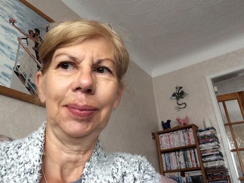 Customer photo review of Nikoro™ : GET YOUR SKIN TIGHTENED AND LIFTED IN JUST 3 MINUTES A DAY