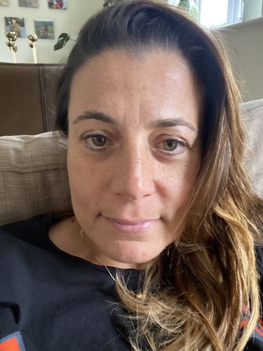 Customer photo review of The Beauty Bundle - Perfect Skin Routine