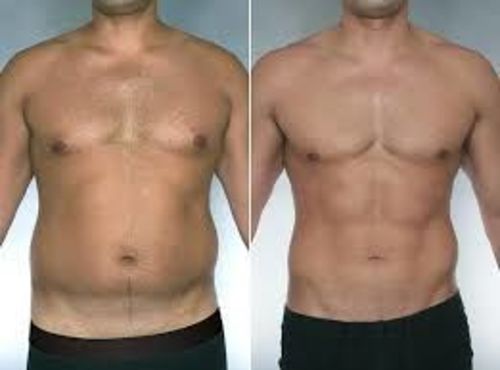 Customer photo review of FitKry™ - T-shirt minceur