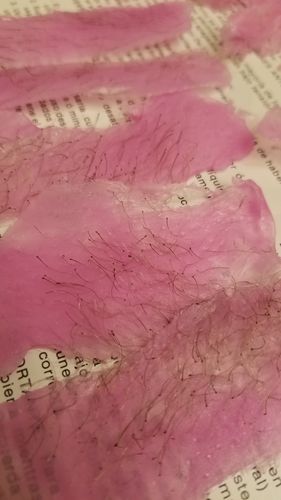 Customer photo review of At-Home Signature Series Hair Removal Wax