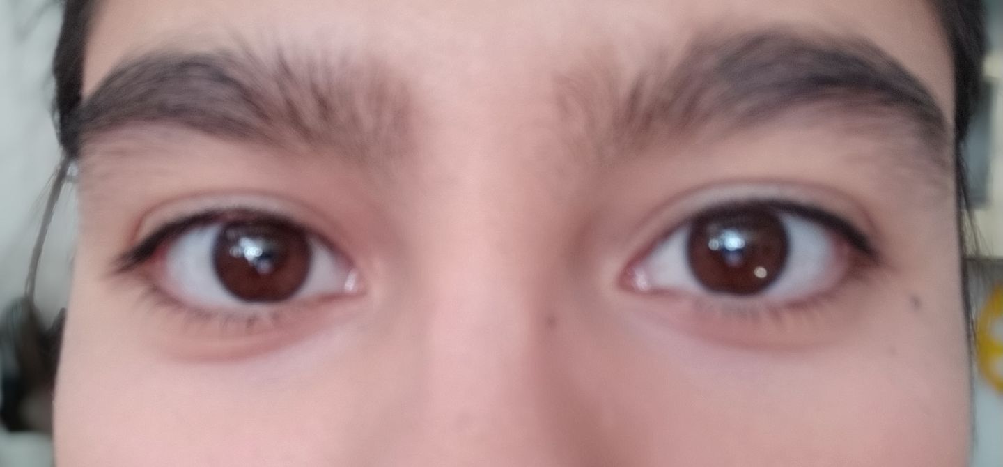 Customer photo review of Corrector AVELLANA