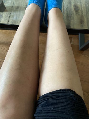 Customer photo review of 9 Minute Tan Mousse