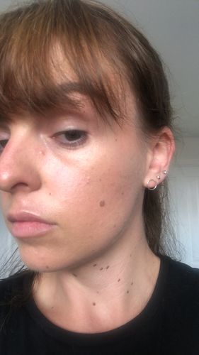 Customer photo review of Rosalique 3 in 1 Anti-Redness Miracle Formula SPF50