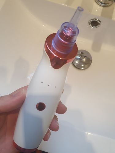 Customer photo review of SkinGlow Electric Cleanser - No More Blackheads