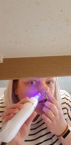 Customer photo review of SkinGlow Electric Cleanser - No More Blackheads