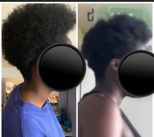 Customer photo review of Inches - Ayurvedic Hair & Beard Growth Oil