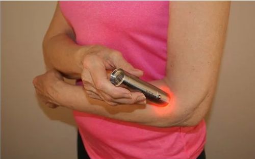 Customer photo review of LUMIPAX™ Portable Rapid Muscle & Joint Pain Relief Device